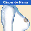 cancer-mama