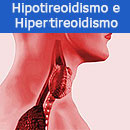 Hipotireoidismo e Hipertireoidismo