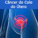 cancer-colo-utero